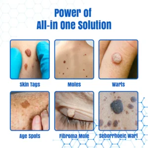 Bikenda® DermZap Mole & Wart Removal Laser Pen